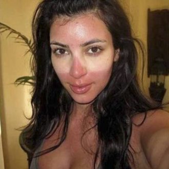 Coup de soleil de Kim Kardashian